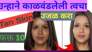 उन्हाने काळवंडलेली त्वचा,Tan skin उजळ करा फक्त 10 मिनिटात मिळवा नितळ गोरी त्वचा, घरगुती उपाय