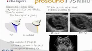 USG Aloka ProSound F75