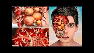 ASMR Remove Worm & Deep Cleaning Maggot Infested Eyes, Dog Ticks   Severely Injured Animation