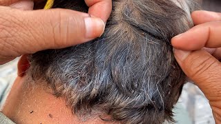 #nitspicking  wife removed husband lices super video || long hair find lice and remove💯part11🧒