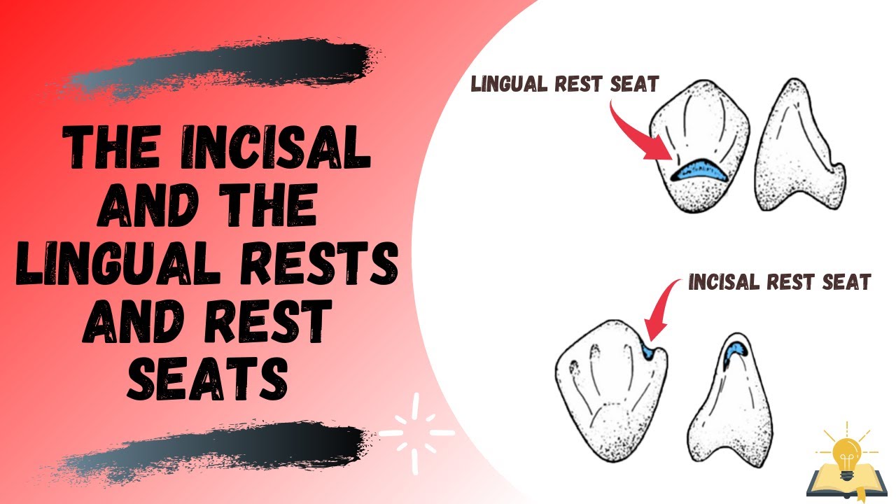 Incisal And The Lingual Rest And Rest Seat | Part III | Removable ...