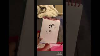 Hyperpigmentation (original video)