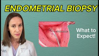 What is an Endometrial Biopsy? OBGYN Explains
