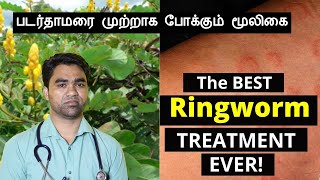 படர்தாமரை போக்கும் சீமை அகத்தி மூலிகை | Best herb for ring worm in Tamil | Cassia alata