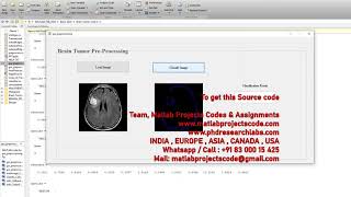 BRAIN TUMOR CLASSIFICATION USING SVM MATLAB PROJECTS www.matlabprojectscode.com