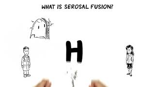 What Is Serosa Fusion