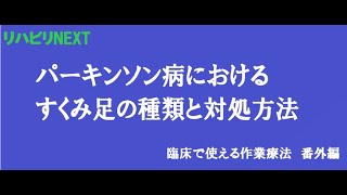 【パーキンソン病】すくみ足の種類と対処方法