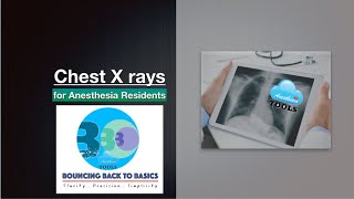 Chest X rays - for Anesthesia Residents #AnesthesiaTOOLS #saneeshpj