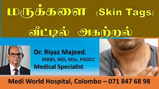 மருக்களை வீட்டில் இலகுவாக அகற்றுவதெப்படி | Skin Tags |  Remove Skin Tags at Home | Dr . Riyaz Majeed