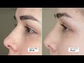 inlei® lash filler 25.9 protocollo di lavoro