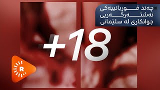 +18 نەشتەرگەری جوانکاریی دەکەی؟ ئەم راپۆرتە ببینە