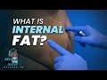 Where is the Internal FAT? | BTM4 Ep.19