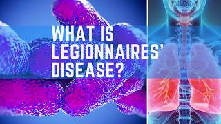 What is Legionnaires Disease?