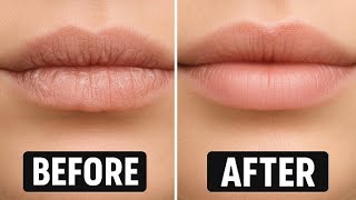 Say Goodbye to Dry Lips! 💋 5-Min DIY Lip Care That Works Fast” @Nkechiscorner #diyshorts #lipcare
