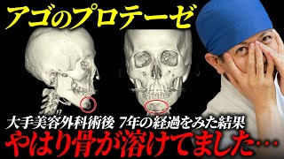 【3DCTで発覚】大手美容外科“TOPドクター”のアゴ、鼻プロテーゼが曲がってる！骨も溶けてる！！美容外科歴20年の専門家が詳しく解説します。