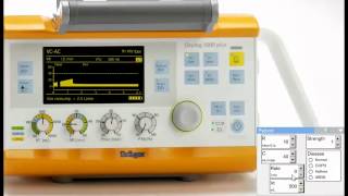 Using the Oxylog 3000 simulator to show patient ventilator asynchrony