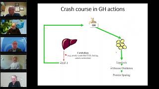 The changing landscape  of adult GH deficiency