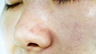 Tips for oily skin |#beauty #beautytips  எண்ணெய் சருமம் போக| குறிப்பு