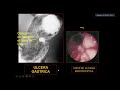 diagnóstico por imágenes clase 18.2 radiología de estómago y duodeno 🤠 17 02
