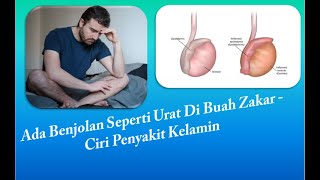 Ada Benjolan Seperti Urat Di Buah Zakar - Ciri Penyakit Kelamin