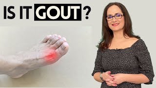 #082 Gout - Everything You Need to Know