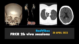 RadVibes FRCR 2b viva sessions: April 30 2023