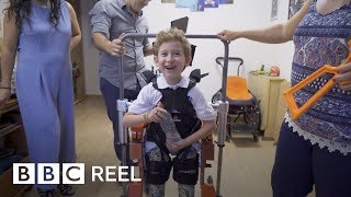 The boy with the robot body - BBC REEL