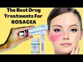 The Best Drug Treatments For ROSACEA | Rosacea Prevention Tips