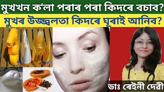 মুখৰ উজ্জ্বলতা কিদৰে ঘূৰাই আনিব পাৰি| dark skin| melasma| DrRaineesHealthyWay