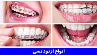 انواع ارتودنسی | دکتر احسان مهریزی