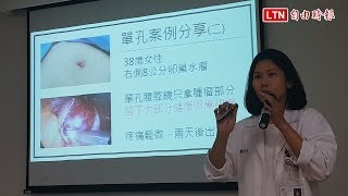 醫病》傷口小、疼痛小 腹腔鏡手術減少女性困擾