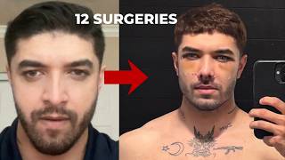 The Average Guy Needs 20 SURGERIES To Ascend
