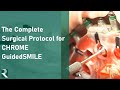 CHROME GuidedSMILE: The Complete Full Arch Surgical Protocol