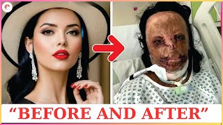 Famous Hollywood Stars Who Completely Ruined Their Faces with Plastic Surgery | Then and Now 2025