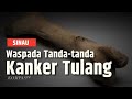 Hati-Hati Gejala Kanker Tulang yang Tidak Kita Disadari | SINAU