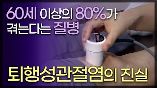 60세 이상 성인의 80%가 겪고 있는 퇴행성관절염 /젊은 층 환자도 늘고 있다 / 퇴행성관절염 / TV닥터인사이드 부산MBC 120831 방송