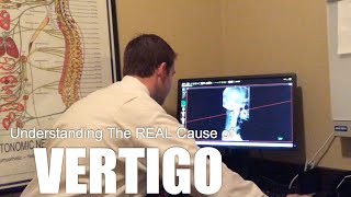 Understanding The REAL Cause of Vertigo - Dacula, GA Chiropractor: