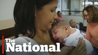 Zika Virus | What Is Microcephaly?