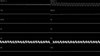 Rei8bit - Roots of Ruin (N163+FDS) - Oscilloscope View