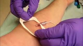 Intravenous Cannulation Technique | Iv Cannulation Technique