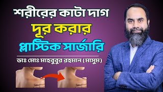 শরীরের কাটা দাগ দূর করার প্লাস্টিক সার্জারি | Dr. Md. Mahbubur Rahman (Masum)