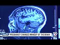 Science shows brain does in fact change during pregnancy