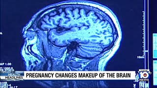 Science shows brain does in fact change during pregnancy
