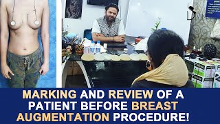Marking And Review a Patient Before Breast Augmentation Procedure | Plastic Surgery India