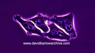 HeLa Cells Dividing