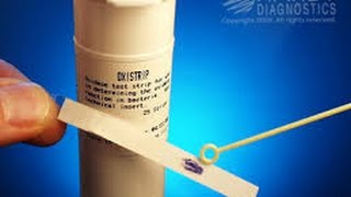 Microbiology oxidase test