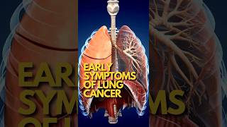 Early symptoms of Lung Cancer | Dr Jamal A Khan