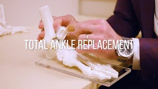 Ankle Replacement Surgery