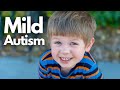 12 Signs of Mild Autism