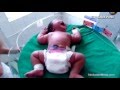 Meet the world's heaviest newborn